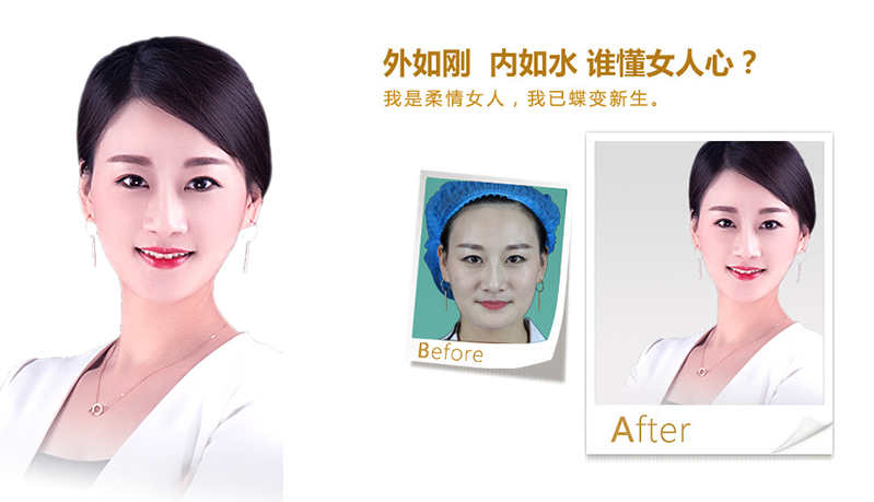 黄石V脸、线雕隆鼻